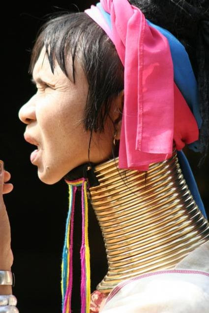 İşkence gibi güzellik anlayışı - Resim: 1