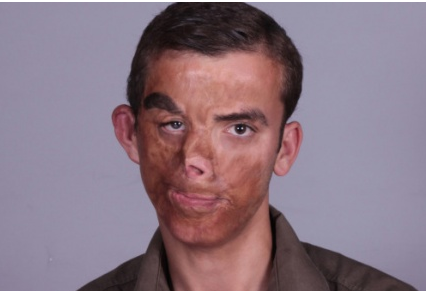 Uğur Acar'ın son hali şoke etti - Resim: 1