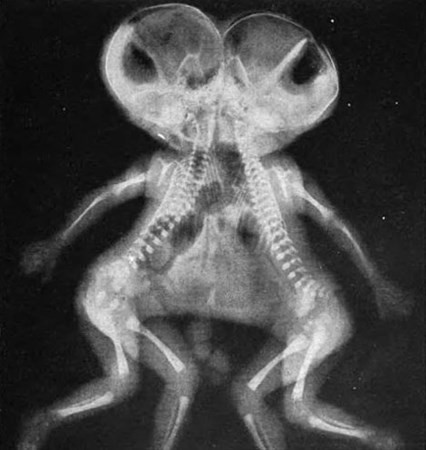 Röntgende her şey görüntülendi! İçine soktuğu şişe mideden çıktı - Resim: 1