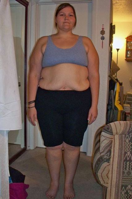 Sarkan derisinden kendine meme yaptırdı! - Resim: 2