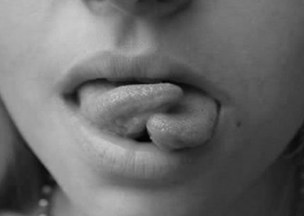 Onların her yeri delik deşik - Resim: 2