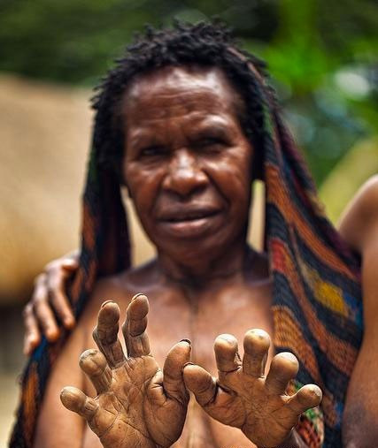 Böyle korkunç gelenek görülmedi! Eşler ölünce parmaklar kesiliyor - Resim: 2