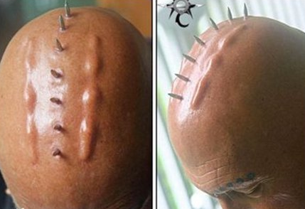 Onların her yeri delik deşik - Resim: 4