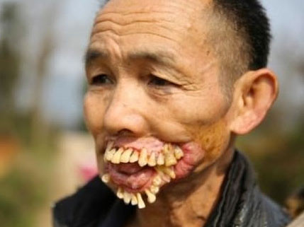 Dünyanın en tuhaf hastalıkları - Resim: 3