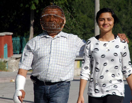 Sigara içmemek için başını kafese kilitliyor! - Resim: 3