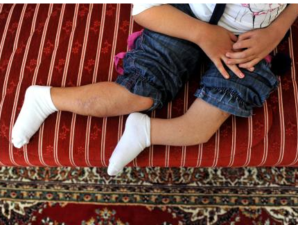 Kırılmasın diye tepsiyle taşınıyor - Resim: 1