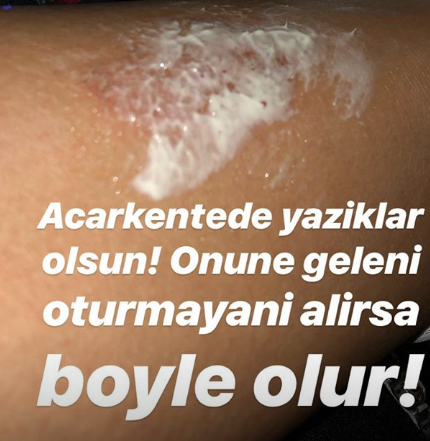 Demet Akalın ateş püskürdü! "Beyinsiz, ana avrat..." - Resim: 3