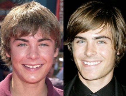 Ünlülerin dişleri şoke etti - Resim: 2