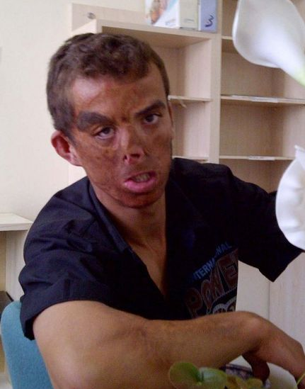 Uğur Acar'ın son hali şoke etti - Resim: 2