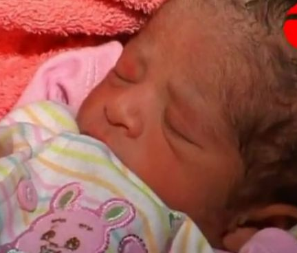 6 bacaklı bebek dehşete düşürdü - Resim: 4