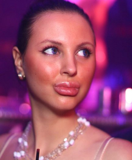 Güzelleşmek uğruna ördekleşen insanlar - Resim: 2