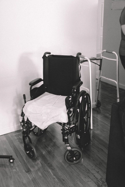 İçtiği şey yüzünden kafasının yarısını kaybetti görenler inanamıyor - Resim: 3