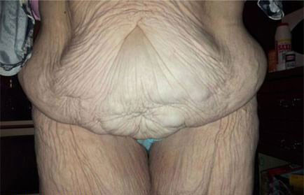 Kilo verdikten sonra hayatı kabusa döndü - Resim: 2