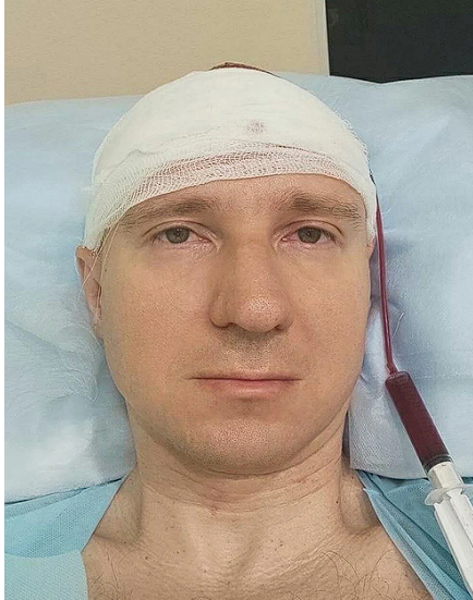 Rüyalarını kontrol etmek isteyen adam kafatasını matkapla deldi sonra da... - Resim: 1