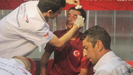 Acun Ilıcalı'nın kaşı yarıldı - Resim: 4