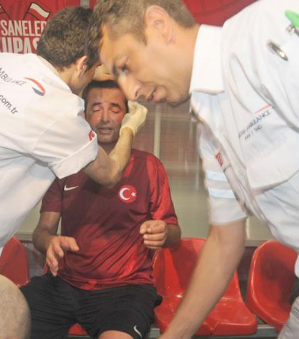 Acun Ilıcalı'nın kaşı yarıldı - Resim: 3