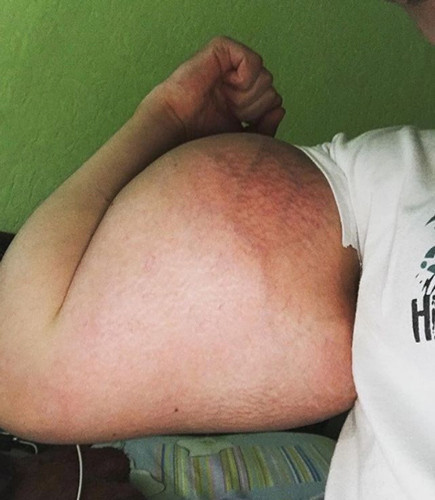 Tam bir felaket kolları bakın neden bu hale geldi - Resim: 4