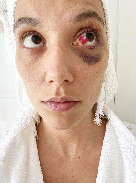 Ozan Güven fotoğrafını paylaşıp bakın ne yazdı Deniz Bulutsuz'u dövüp darp raporu aldı - Resim: 2