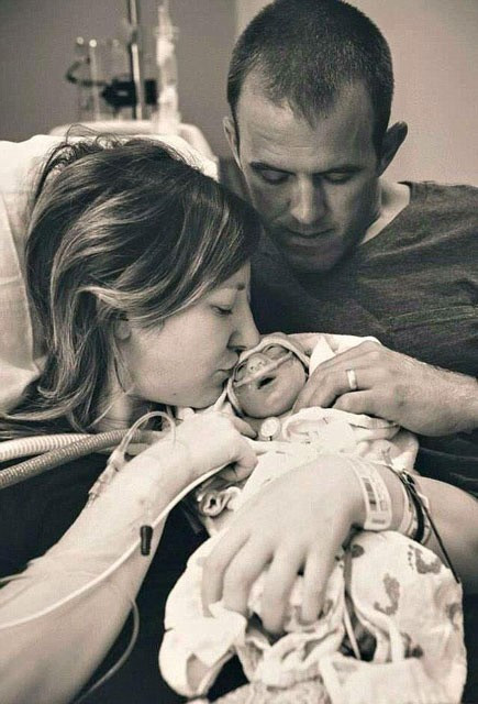 Bebeğinin öleceğini bile bile doğum yaptı bakın neden - Resim: 1