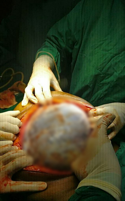 Herkes onu hamile sandı ama karnından öyle bir şey çıktı ki - Resim: 3