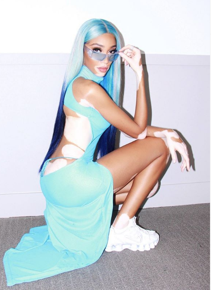 Vitiligo'lu model Winnie Harlow uçak pozu nedeniyle eleştirilere maruz kaldı - Resim: 1