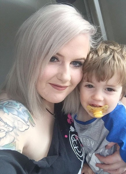 Diş fırçalarken yüz felci geçirdi! - Resim: 1