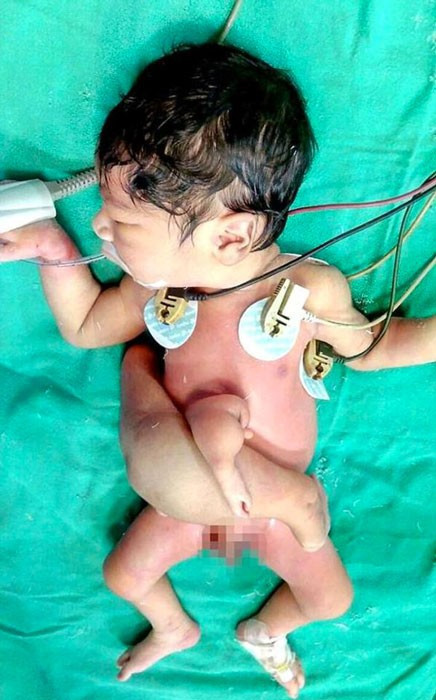 Bebek bu halde doğdu ailesi onu korkunç şekilde öldürmek istedi  - Resim: 4