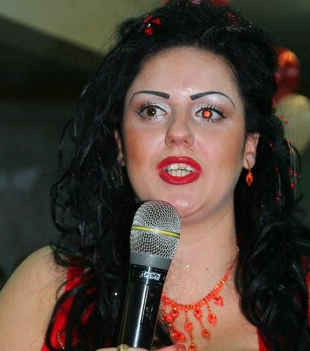 Garip gibi görünse de onlar evlendi! - Resim: 2