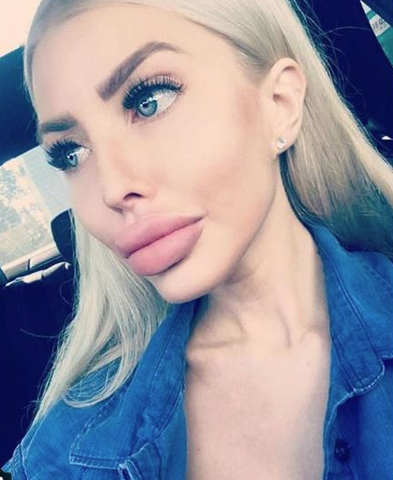 Barbie bebeğe benzemek istemişti! Servet harcayıp inanılmaz değişti - Resim: 3