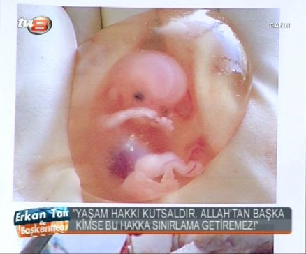 Melih Gökçek faturayı CHP'ye kesti! - Resim: 4