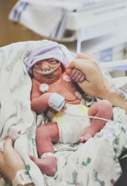 Bebeğinin öleceğini bile bile doğum yaptı bakın neden - Resim: 3