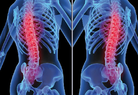 Bel ağrısıyla gelen 5 hastalık - Resim: 3