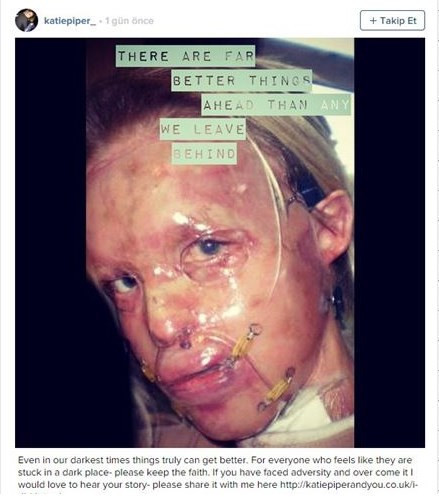 110 ameliyattan sonra yeniden mutlu! - Resim: 1