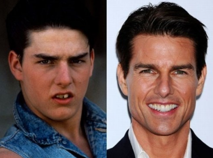 Ünlülerin dişleri şoke etti - Resim: 1