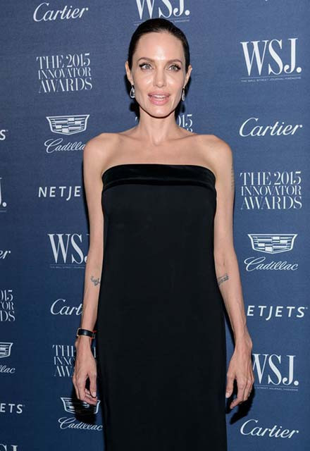 Aşırı zayıflığının nedeni belli oldu - Resim: 2