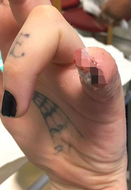 Sevgilisine hediye diye parmağını kesip verdi inanılmaz! - Resim: 2