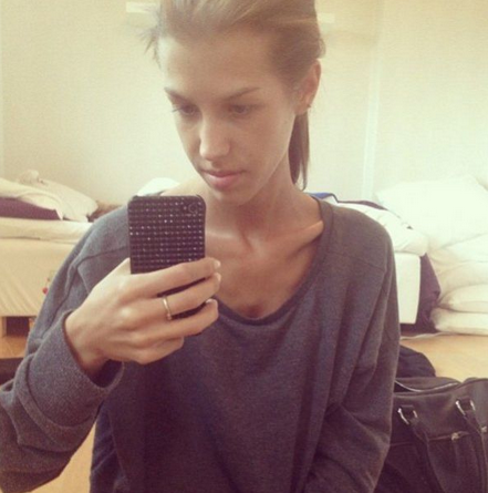 Zayıflamak isterken ölüyordu - Resim: 2