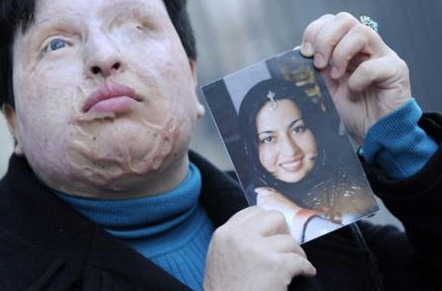 O adamı son anda affetti - Resim: 4