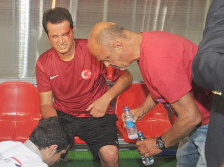 Acun Ilıcalı'nın kaşı yarıldı - Resim: 2