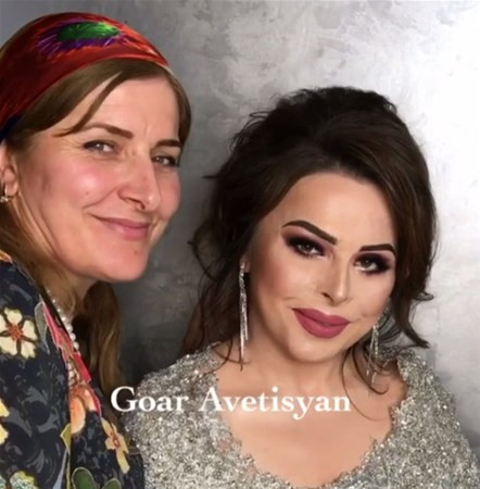 Yüzü yanınca bu hale geldi bakın sonra neler oldu  - Resim: 4