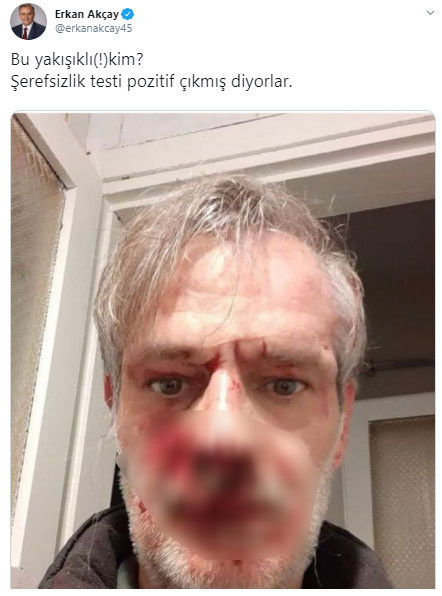 MHP'li Akçay dayağın fotoğrafını paylaştı - Resim: 0