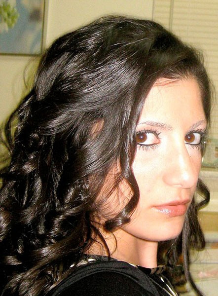 Burun estetiği yaptırdı şimdi nefes alamıyor - Resim: 4