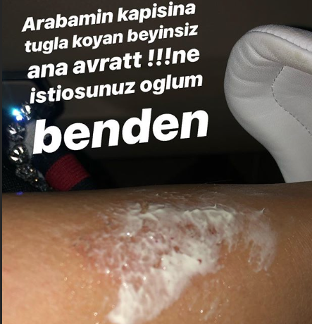 Demet Akalın ateş püskürdü! "Beyinsiz, ana avrat..." - Resim: 2