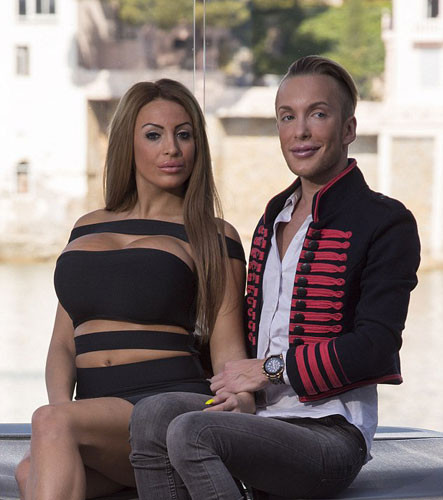 Böyle takıntı mı olur binlerce estetik operasyon geçirdiler ama... - Resim: 3