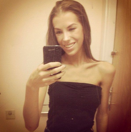 Zayıflamak isterken ölüyordu - Resim: 1