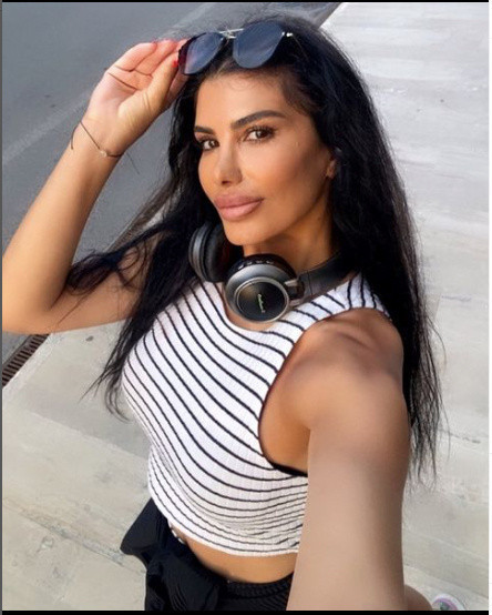 Şarkıcı Hatice dişinden tırnağına başka biri oldu! Estetikli halini gören doktorunu tebrik ediyor "değişime bakın" - Resim: 3