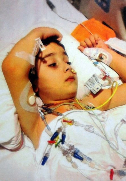 5 yılda tam 70 ameliyat geçirdi - Resim: 4