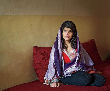 Afgan kızın yeni burnu şaşırttı - Resim: 2