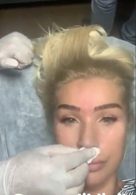 Seda Sayan estetik yaptırdığı anları paylaştı! Bu kez dudağını kaldırttı - Resim: 1