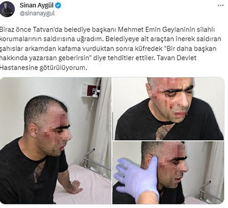 Gazeteci Sinan Aygül saldırıya uğradı! Gazeteci döven koruma memuru açığa alındı - Resim: 0